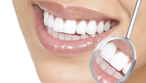 Modificari de culoare ale dintilor vitali – cauze si tratament